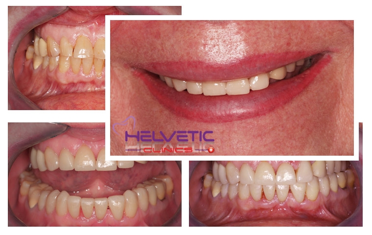 Helvetic Dental Clinic Hotel