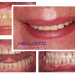 Helvetic-Dental-Clinics-Hotel-760×480