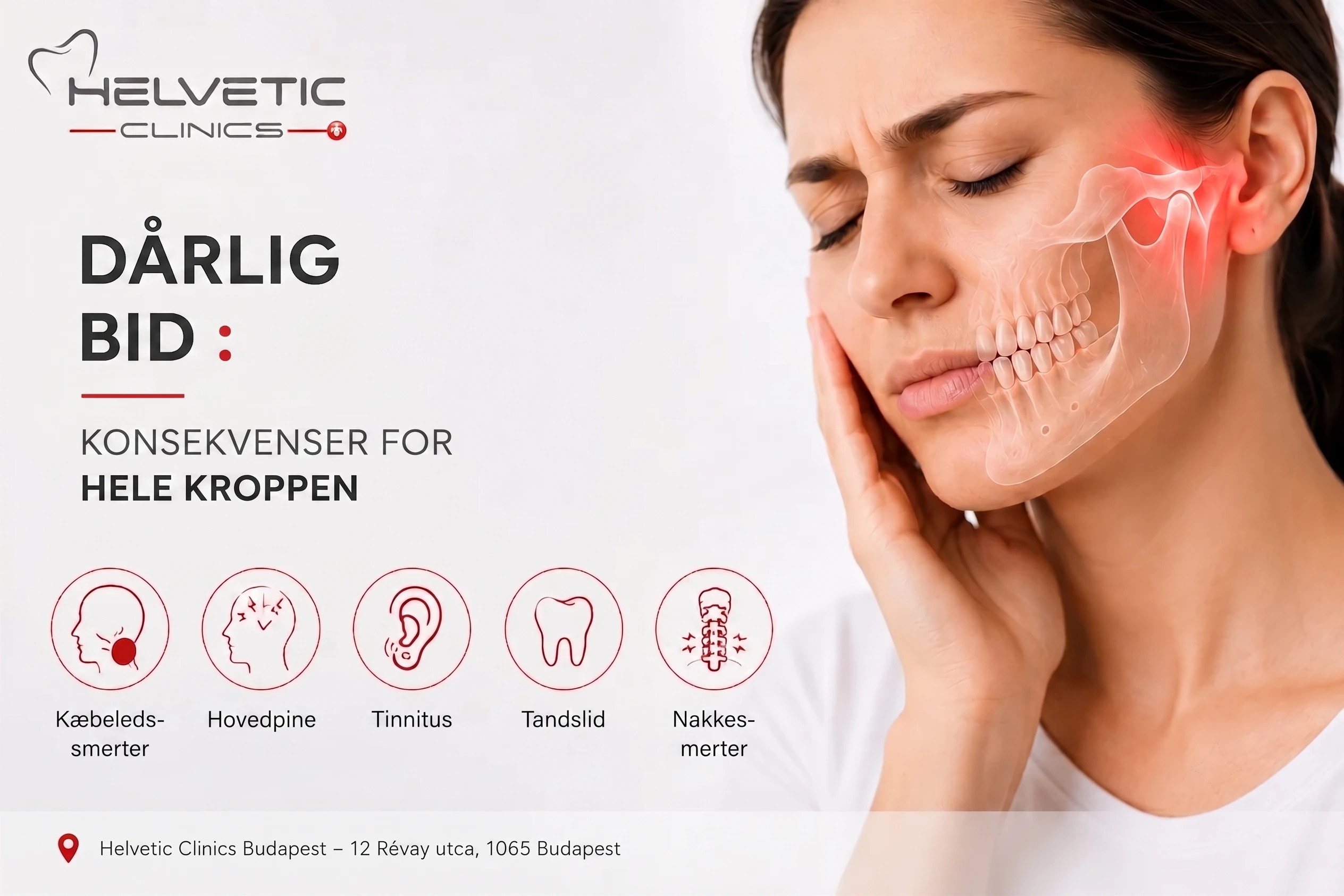 Forkert tandstilling (malokklusion) der forårsager TMJ-smerter, hovedpine, tinnitus, tandslid og nakkesmerter – Helvetic Clinics Budapest.